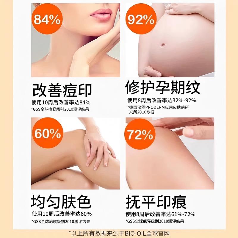 百洛油(Bio-0il)身体油多用护肤油 按摩油 妊娠油保湿滋润 125ml
